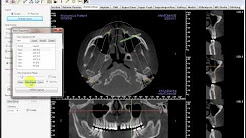 anatomage in vivo viewer download